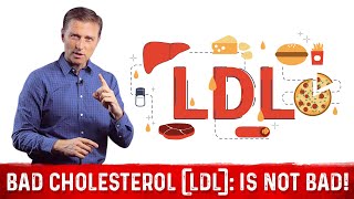 What is LDL Cholesterol – DrBerg on LDL Bad Cholesterol Part 4 [upl. by Oap859]