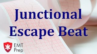 Junctional Escape Beat ECG  EMTprepcom [upl. by Allbee]