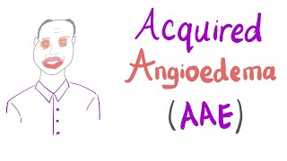 Acquired Angioedema AAE [upl. by Nessa]