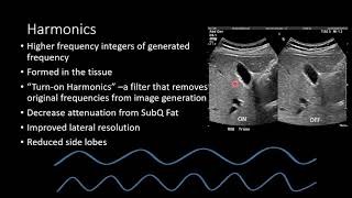 Ultrasound Physics  Image Generation [upl. by Eurd]