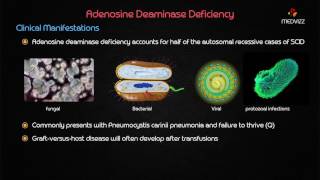 Adenosine deaminase ADA deficiency [upl. by Rebmaed]