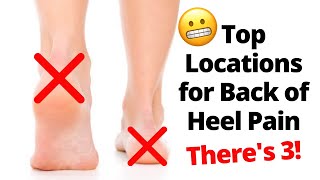 Back of The Heel Pain Locations [upl. by Silirama151]