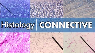 Histology  Connective Tissue [upl. by Nealon963]