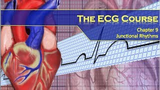 The ECG Course  Junctional Rhythms [upl. by Ajit]