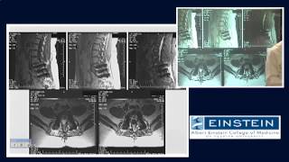 Introducing MRI Artifacts 46 of 56 [upl. by Ion579]